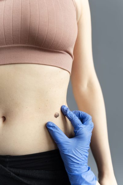 mano con guante midiendo mole